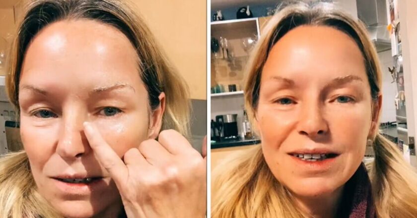 Simple 25p no-Botox hack could help you look ’30 years younger’