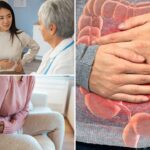 After IBS diagnosis, lifestyle changes, dietary shifts and medications prescribed can help ease symptoms