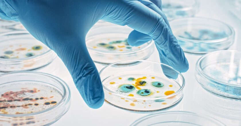 Superbugs due to antibiotic resistance could kill 39 million by 2050: study