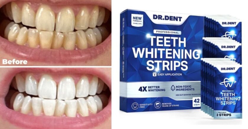 Shoppers get ‘compliments on white teeth’ after using £20 Amazon buy