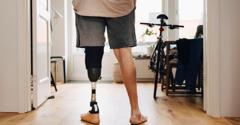 Insurers limit coverage of prosthetic limbs, questioning their medical necessity