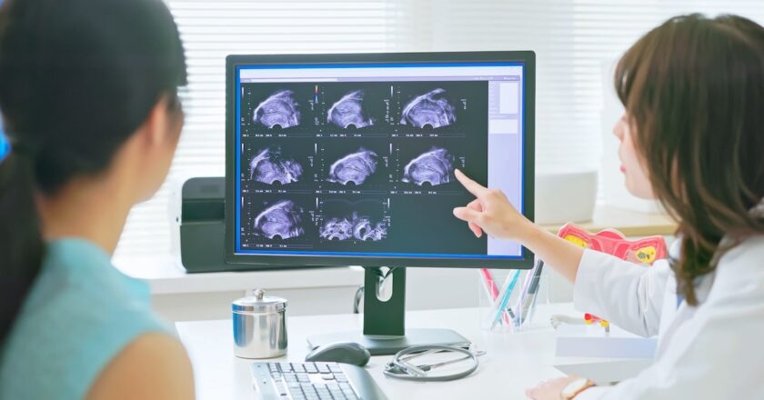 AI detects ovarian cancer better than human experts in new study