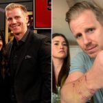 Former ‘Bachelor’ star Sean Lowe attacked by his own dog twice