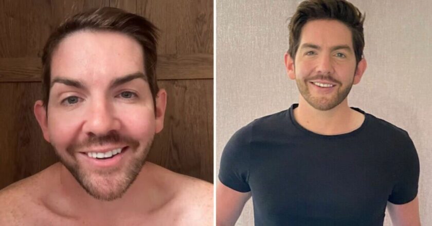 Actor sees ‘baby hair sprouting’ after taking supplements
