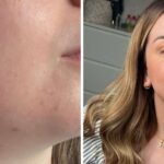 My skin was smoother and more youthful after using 1 skin tool for 6 weeks