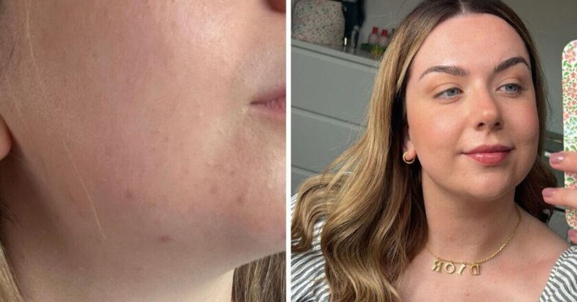 My skin was smoother and more youthful after using 1 skin tool for 6 weeks