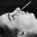 neuf décennies de neurotechnologies à travers le monde