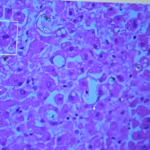 How nanoplastics may be impacting our long-term health