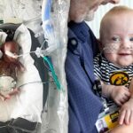 Iowa baby, born at 21 weeks, holds world record as the most premature