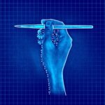 L’intelligence artificielle à la rescousse de la médiation de l’assurance