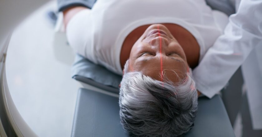 Scientists discover way to melt protein clusters before Alzheimer’s starts