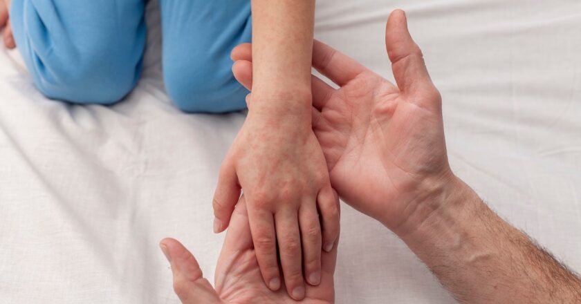 Measles outbreak forces 254 people into quarantine in South Carolina county