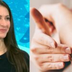 Dermatologist shares tips to help dry winter skin