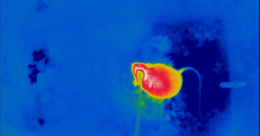 La température de la peau aurait un lien avec le déclenchement des crises de narcolepsie