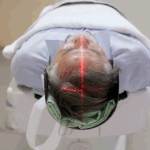 Brain disorder quadruples dementia risk in older adults, study finds