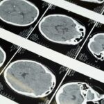 China develops ultrasound brain-computer interface without surgery