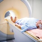 Microplastics found in prostate cancer tumors in NYU Langone study