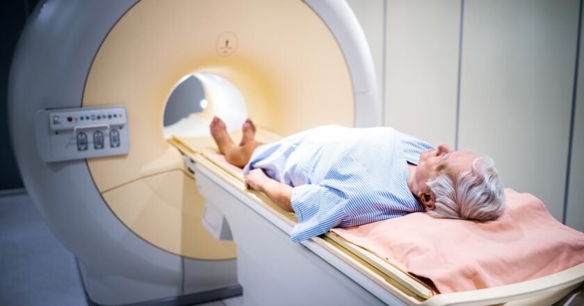 Microplastics found in prostate cancer tumors in NYU Langone study