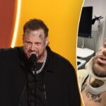 Jelly Roll attended 2026 Grammy Awards with ‘secret’ broken collarbone